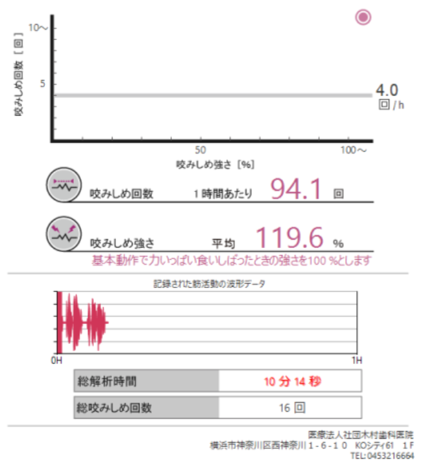 画像@(咀嚼時の例:強い咀嚼/ゆっくり食べる必要があるケース)