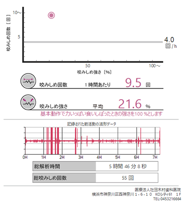 画像A(図:睡眠時バースト回数/基準値4回/時間)
