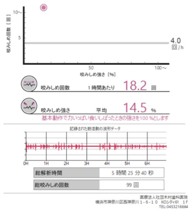 画像C(睡眠時の例:ストレスを強く自覚している方のケース)