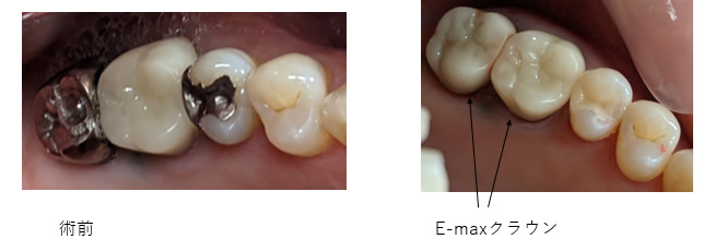 E-max@C[}bNX